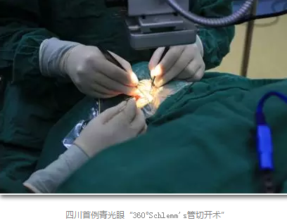 成都金沙澳门(中国)唯一官方网站已经开展的青光眼手术有：引流阀 (钉)植入手术(2015年以来已200多 )，360°Schlemm's管切开术，激光CO2 辅助巩膜深层切除术，小梁切除术青(光眼)白(内障)联合手术。还有虹膜周切术、前房成形术、 虹膜复位术，睫状体冷冻术，小梁切开术和前房穿刺术等6.png