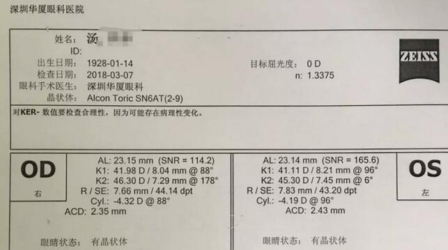 3月12日下午，已经90高龄的离休东江纵队老兵汤爷爷，在深圳金沙澳门(中国)唯一官方网站检查之后，白内障专科邢宝刚主任为其实施左眼白内障超声乳化摘除，联合散光人工晶体植入术。2.jpg