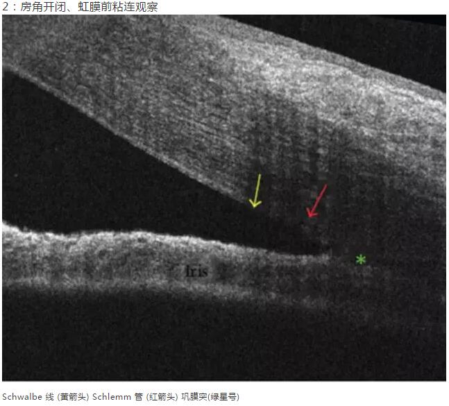金沙澳门(中国)唯一官方网站课堂：后节频域OCT前节模块的运用12.jpg