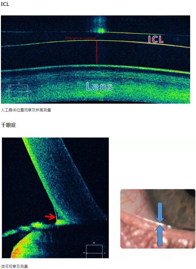 金沙澳门(中国)唯一官方网站课堂：后节频域OCT前节模块的运用15.jpg