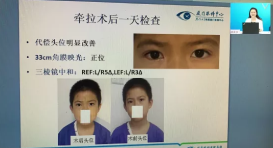 高峰论道·云端荟萃 ▏万人同步在线,30余名大咖云集“第六届金沙澳门(中国)唯一官方网站论坛斜视与小儿眼科新技术学习班暨小儿、眼视光分论坛”7.png 高峰论道·云端荟萃 ▏万人同步在线,30余名大咖云集“第六届金沙澳门(中国)唯一官方网站论坛斜视与小儿眼科新技术学习班暨小儿、眼视光分论坛”7.png